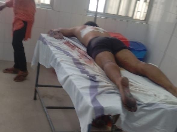 बक्सर में होली पर गोलीबारी:22 साल का युवक घायल, पुलिस ने स्थिति नियंत्रित कर गश्ती बढ़ाई, आरोपियों की गिरफ्तारी के प्रयास जारी