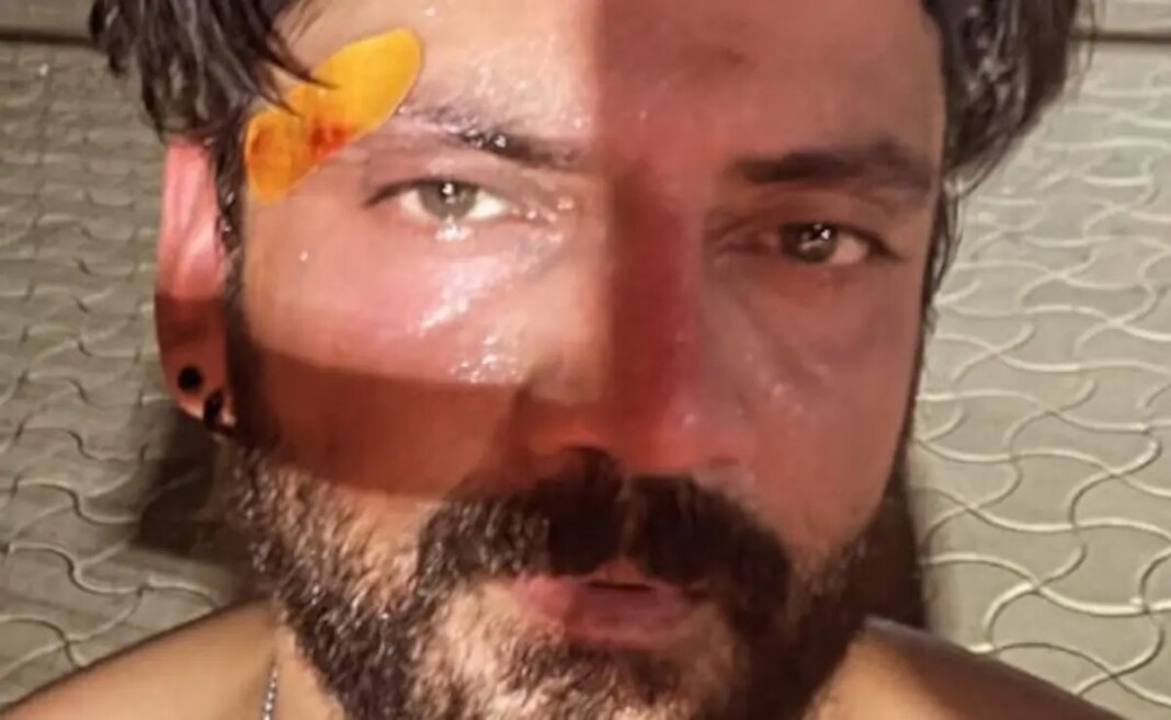 Zaheer Iqbal Suffers Injury While Playing Sports. See Pic Phe4js88 s 625x300 09 April 26.jpg