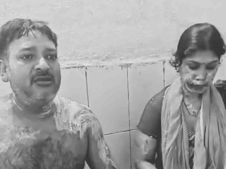 ढाई साल के मासूम सहित तीन पर एसिड अटैक:मोतिहारी में पैसे के लेनदेन विवाद में परिवार पर हमला, पीड़ित पर FIR का आरोप