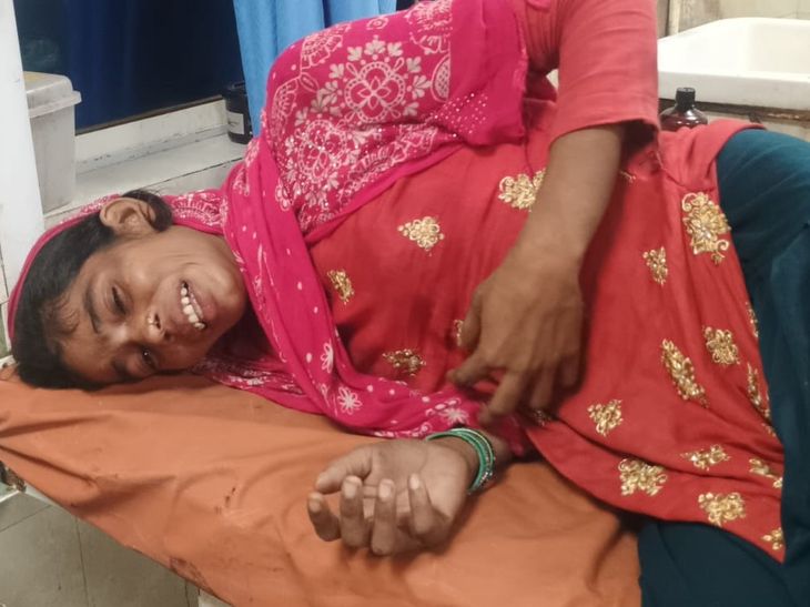 घोरमारा गांव में महिला से मारपीट:ससुराल पक्ष के लोगों पर लाठी-डंडों से मारपी का आरोप, सदर अस्पताल में भर्ती