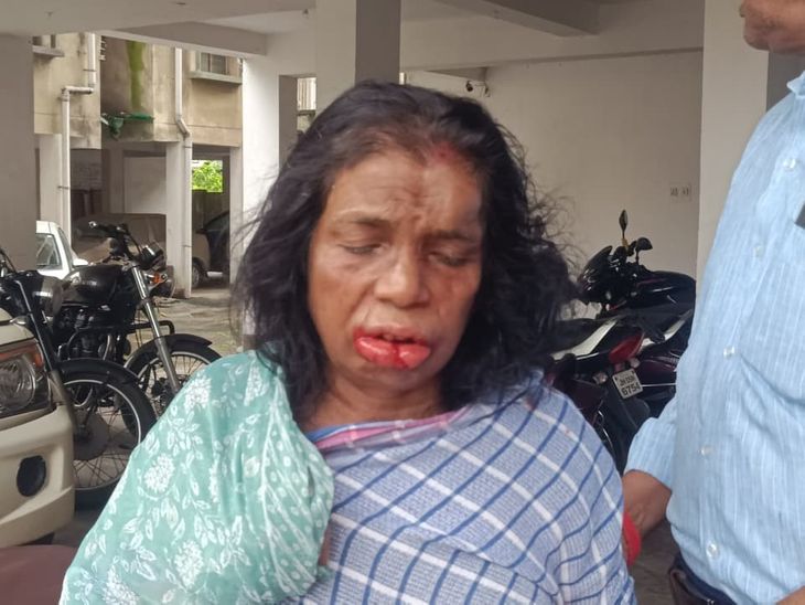 जनगणना कर्मी बनकर महिला के फ्लैट में लूट:बदमाशों ने मारपीट कर जेवर लूटे, महिला को बंधक बनाया, विरोध करने पर तोड़ा दांत