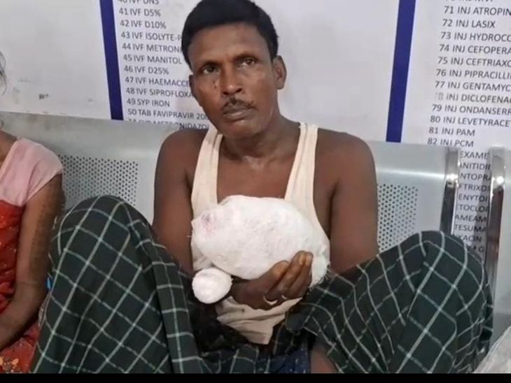 सूअर के शिकार के लिए बम लगाते समय उड़ा हाथ:पलामू में घायल ने पुलिस को खुखड़ी चुनने की झूठी कहानी सुनाई, जांच जारी