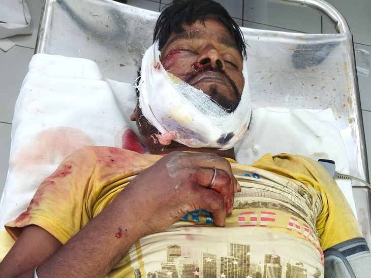 यमुनिया में टेंपो-बाइक की टक्कर, चालक गंभीर:प्राथमिक उपचार के बाद मधेपुरा मेडिकल कॉलेज रेफर, टेंपो चालक फरार