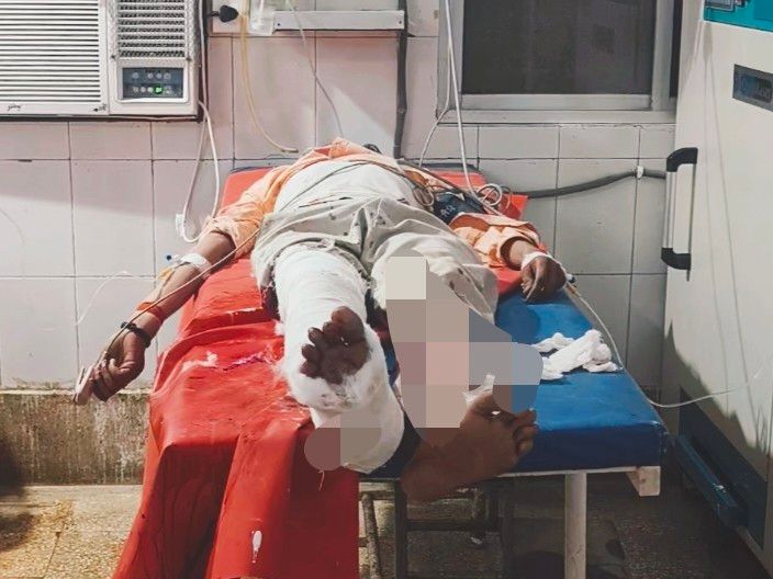 शेखपुरा में 2 बाइक की टक्कर, युवक गंभीर घायल:ससुराल से लौटते समय एक्सीडेंट; 4 महीने पहले हुई थी शादी, PMCH रेफर