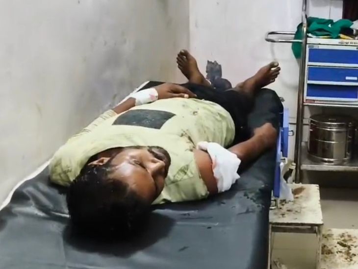 जमीन विवाद में ऑटो ड्राइवर पर फायरिंग, सदर अस्पताल रेफर:बांका में सवारी उतारने के बाद बदमाशों ने हाथ में मारी गोली, FIR दर्ज