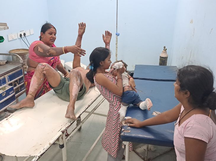 गोपालगंज में खाना बनाते समय गैस सिलेंडर में आग लगी:सफियाबाद गांव में मासूम समेत 16 लोग झुलसे, अस्पताल में भर्ती